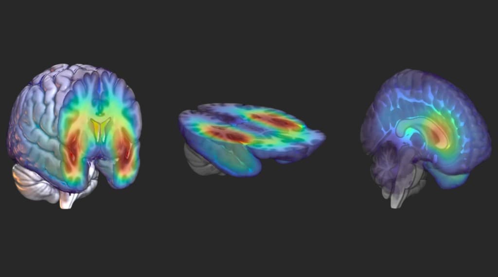 Tumor Grading Analysis